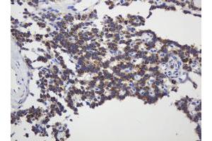 Image no. 4 for anti-Glyceraldehyde-3-Phosphate Dehydrogenase, Spermatogenic (GAPDHS) antibody (ABIN1498375)