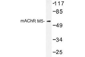 Image no. 1 for anti-Cholinergic Receptor, Muscarinic 5 (CHRM5) antibody (ABIN317740) (CHRM5 抗体)