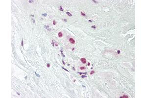 Anti-DPPA4 antibody IHC of human placenta. (DPPA4 抗体  (AA 1-50))