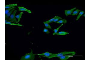 Immunofluorescence of monoclonal antibody to EN2 on HeLa cell. (EN2 抗体  (AA 86-210))