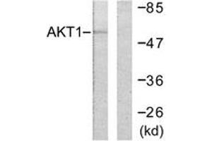 Western blot analysis of extracts from HeLa cells, treated with Etoposide 25uM 24h, using Akt (Ab-246) Antibody. (AKT1 抗体  (AA 212-261))