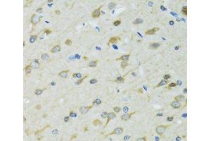 Immunohistochemistry of paraffin-embedded Rat brain using DCTN2 Polyclonal Antibody at dilution of 1:100 (40x lens). (Dynamitin 抗体)