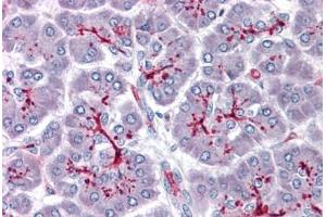 Human Pancreas: Formalin-Fixed, Paraffin-Embedded (FFPE) (SLAIN1 抗体  (C-Term))