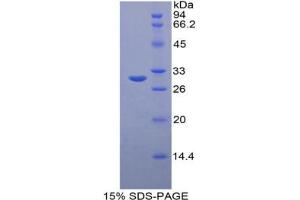 SDS-PAGE analysis of Mouse OCT Protein. (OTC 蛋白)