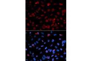 Immunofluorescence analysis of U2OS cell using SFRS1 antibody. (SRSF1 抗体  (pSer1))