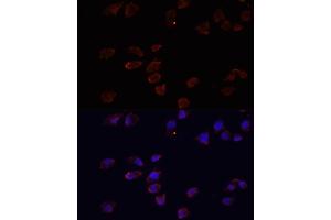 Immunofluorescence analysis of HeLa cells using  antibody (ABIN3021237, ABIN3021238, ABIN3021239 and ABIN6214079) at dilution of 1:100. (ARF6 抗体  (AA 1-175))
