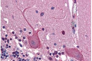 Immunohistochemistry (Formalin-fixed Paraffin-embedded Sections) (IHC (fp)) image for anti-Adaptor-Related Protein Complex 1, gamma 1 Subunit (AP1G1) (AA 574-623) antibody (ABIN6747137)