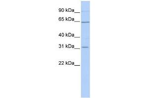 SLC27A2 antibody used at 1 ug/ml to detect target protein. (SLC27A2 抗体)