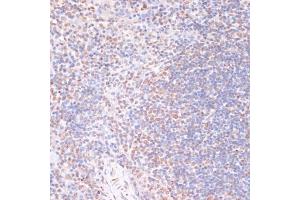 Immunohistochemistry of paraffin-embedded mouse spleen using Phospho-RPS6K-S376 antibody (ABIN7270039) at dilution of 1:100 (40x lens). (MSK1 抗体  (pSer376))