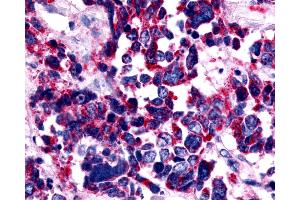 Immunohistochemistry (IHC) image for anti-Endothelin Receptor Type A (EDNRA) (Extracellular Domain) antibody (ABIN1048556)