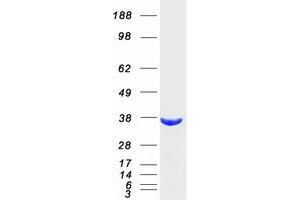 Western Blotting (WB) image for Aldo-Keto Reductase Family 1, Member B10 (Aldose Reductase) (AKR1B10) protein (Myc-DYKDDDDK Tag) (ABIN2714501)