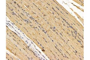 ABIN7095943 and ABIN7100005 at 1/100 staining rat muscle tissue by IHC-P. (EPM2AIP1 抗体)