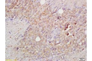 Formalin-fixed and paraffin embedded mouse lymphoma labeled with Rabbit Anti BCMA/CD269 Polyclonal Antibody, Unconjugated (ABIN705041) at 1:200 followed by conjugation to the secondary antibody and DAB staining (BCMA 抗体  (AA 12-110))