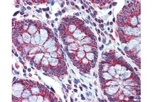 PGLS antibody was used for immunohistochemistry at a concentration of 4-8 ug/ml. (PGLS 抗体  (Middle Region))