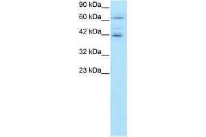 WB Suggested Anti-ETV6 Antibody Titration:  0. (ETV6 抗体  (C-Term))
