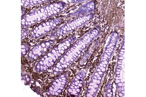 Immunohistochemistry (IHC) image for anti-Annexin A6 (ANXA6) (AA 395-665) antibody (ABIN5692982)