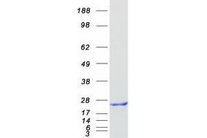 Western Blotting (WB) image for Sorcin (SRI) (Transcript Variant 1) protein (Myc-DYKDDDDK Tag) (ABIN2732364)