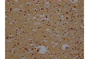 IHC image of ABIN7127436 diluted at 1:100 and staining in paraffin-embedded human brain tissue performed on a Leica BondTM system. (Recombinant XPO1 抗体)