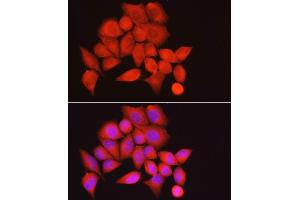 Immunofluorescence analysis of HeLa cells using PPP1R12A Rabbit pAb (ABIN6128260, ABIN6146059, ABIN6146061 and ABIN6213896) at dilution of 1:100 (40x lens). (PPP1R12A 抗体  (AA 1-200))