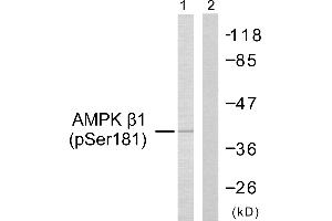 Western blot analysis of extracts from Jurkat cells, using AMPK β1 (Phospho-Ser181) Antibody (#A0410). (PRKAB1 抗体  (pSer181))