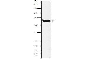 Western blot analysis of Klotho expression in human fetal kidney lysate.