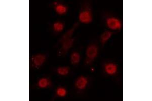 ABIN6274124 staining HuvEc cells by IF/ICC. (SUPT3H/SPT3 抗体  (Internal Region))