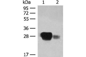 Western blot analysis of Raji cell and Human spleen tissue lysates using HLA-DPB1 Polyclonal Antibody at dilution of 1:350 (HLA-DPB1 抗体)
