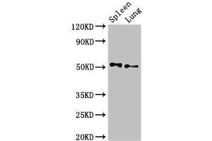 Western Blot Positive WB detected in: Rat spleen tissue, Rat lung tissue All lanes: PSEN2 antibody at 3 μg/mL Secondary Goat polyclonal to rabbit IgG at 1/50000 dilution Predicted band size: 51, 47 kDa Observed band size: 51 kDa (Presenilin 2 抗体  (AA 7-77))