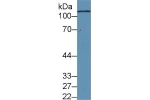 Detection of C5a in Human Serum using Monoclonal Antibody to Complement Component 5a (C5a) (C5A 抗体  (AA 678-751))