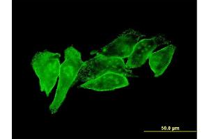 Immunofluorescence of monoclonal antibody to PSCD1 on HeLa cell. (Cytohesin 1 抗体  (AA 1-398))