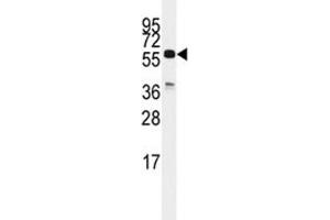 Western blot analysis of CDC25C antibody and K562 lysate.