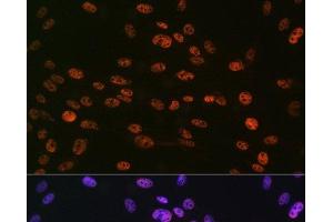 Immunofluorescence analysis of C6 cells using Phospho-Histone H3(S10) Polyclonal Antibody at dilution of 1:100 (40x lens). (Histone 3 抗体  (pSer10))