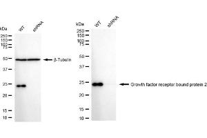 Western blotting analysis using Growth factor receptor bound protein 2 antibody (ABIN7798807).