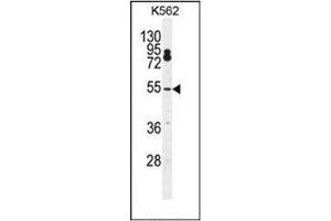 Western blot analysis of CPSF7 Antibody (C-term) Cat. (CPSF7 抗体  (C-Term))