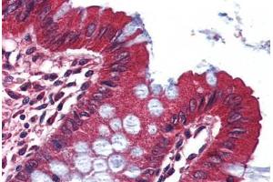 Immunohistochemistry (IHC) image for anti-Potassium Voltage-Gated Channel, Shaker-Related Subfamily, Member 3 (KCNA3) (C-Term) antibody (ABIN1048981)