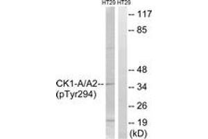 Western blot analysis of extracts from HT29 cells treated with heat shock, using CK-1 alpha (Phospho-Tyr294) Antibody. (CSNK1A1 抗体  (pTyr294))