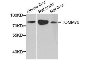 Western blot analysis of extracts of various cell lines, using TOMM70 antibody. (TOM70 抗体  (AA 60-340))