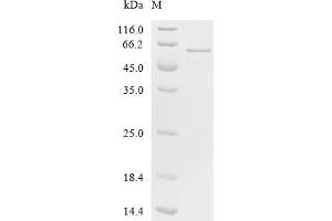 Eukaryotic Translation Elongation Factor 1 alpha 1 (EEF1A1) (AA 1-462), (full length) protein (His tag)