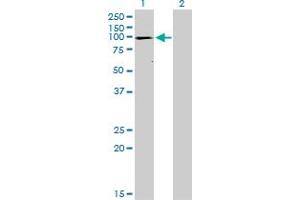 Western Blotting (WB) image for anti-ATPase, Ca++ Transporting, Cardiac Muscle, Fast Twitch 1 (ATP2A1) (AA 522-612) antibody (ABIN559993)