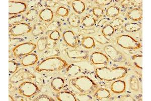 Immunohistochemistry of paraffin-embedded human kidney tissue using ABIN7172505 at dilution of 1:100