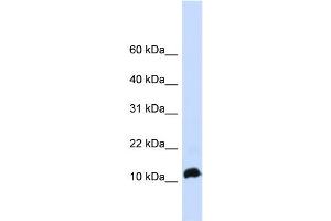 WB Suggested Anti-NHLH1 Antibody Titration: 0. (NHLH1 抗体  (Middle Region))