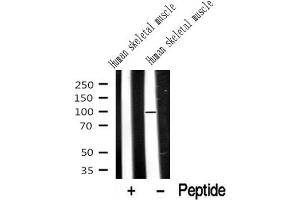 Western blot analysis of extracts of Human skeletal muscle? (Dystroglycan 抗体  (C-Term))