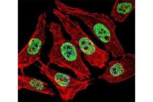 Fluorescent confocal image of A549 cell stained with FOXA2 antibody at 1:25. (FOXA2 抗体  (AA 128-157))