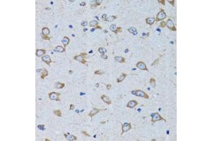 Immunohistochemistry of paraffin-embedded rat brain using RARS antibody (ABIN5973728) at dilution of 1/100 (40x lens). (RARS 抗体)