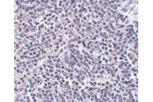 Immunohistochemistry (IHC) image for anti-ADP-Ribosylation Factor-Like 15 (ARL15) (Middle Region) antibody (ABIN1030866) (ARL15 抗体  (Middle Region))