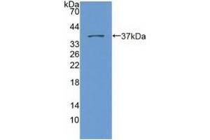 Detection of Recombinant Nesp2, Human using Polyclonal Antibody to Nesprin 2 (Nesp2) (SYNE2 抗体  (AA 6-296))