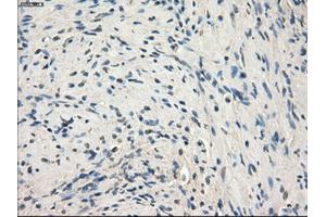 Immunohistochemical staining of paraffin-embedded endometrium tissue using anti-MAP2K1 mouse monoclonal antibody. (MEK1 抗体)