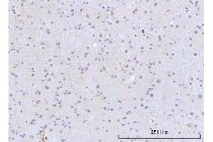 IHC analysis of RBM22 using anti-RBM22 antibody (ABIN7600268).