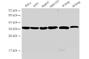 Western Blot analysis of 1)Hela, 2)A431, 3)HepG2, 4)NIH/3T3, 5)Rat lung, 6)Mouse lung using ANXA5 Ployclonal Antibody at dilution of 1:2000. (Annexin V 抗体)