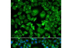 Immunofluorescence analysis of A549 cells using UBE2H Polyclonal Antibody (UBE2H 抗体)